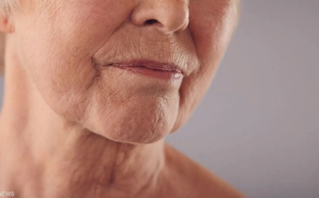 فيتامين سي والتجاعيد.. طبيب يكشف وقت الاستخدام الصحيح