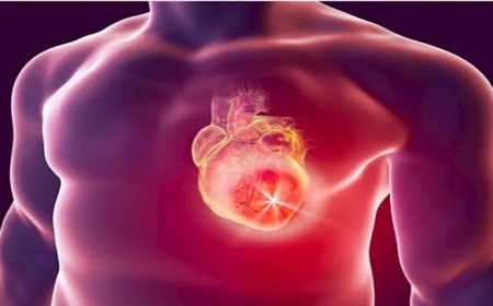 5 أعراض خفية لاحتشاء عضلة القلب