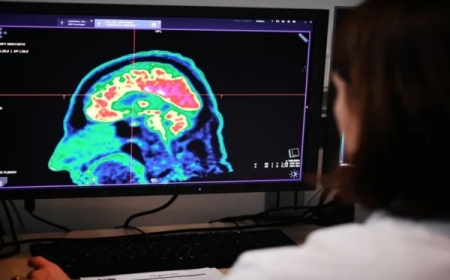 المخ يغتسل أثناء النوم للوقاية من الزهايمر.. دراسة تكشف التفاصيل