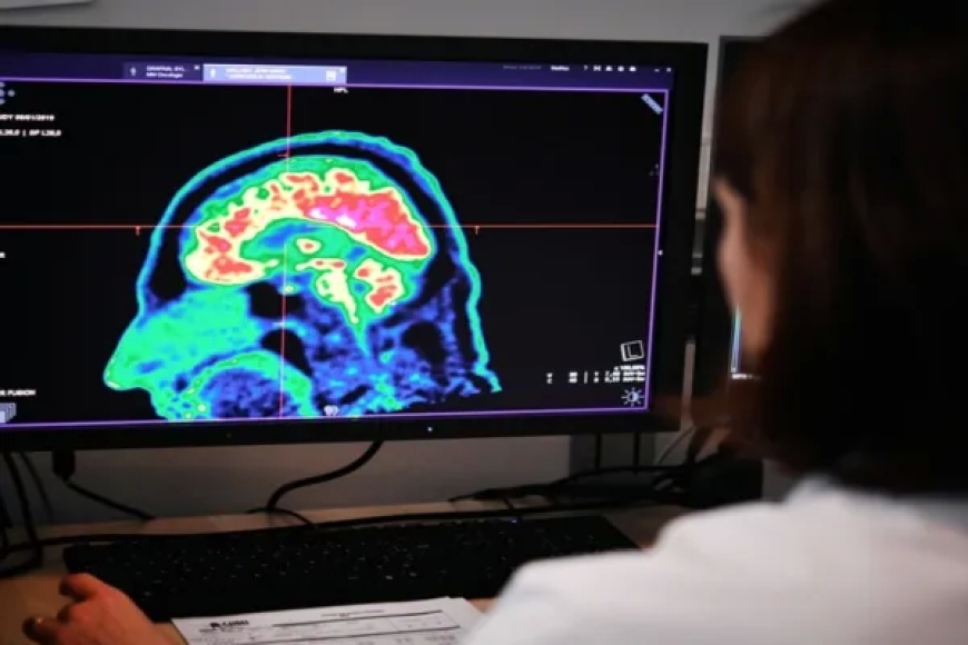 المخ يغتسل أثناء النوم للوقاية من الزهايمر.. دراسة تكشف التفاصيل