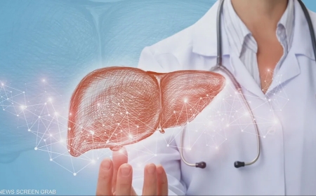 السكر يدمر الكبد.. تقرير يكشف العلاقة الصعبة