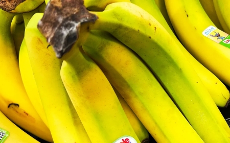 تقرير يكشف علاقة لون الموز بفوائده الصحية