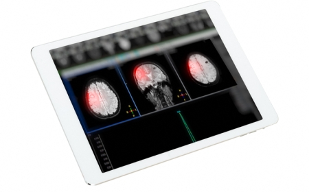 المخ يغيّر وصلاته العصبية بالكامل 5 مرات خلال عمر الإنسان