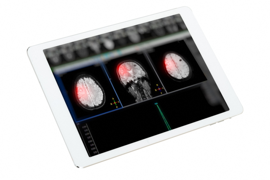 المخ يغيّر وصلاته العصبية بالكامل 5 مرات خلال عمر الإنسان